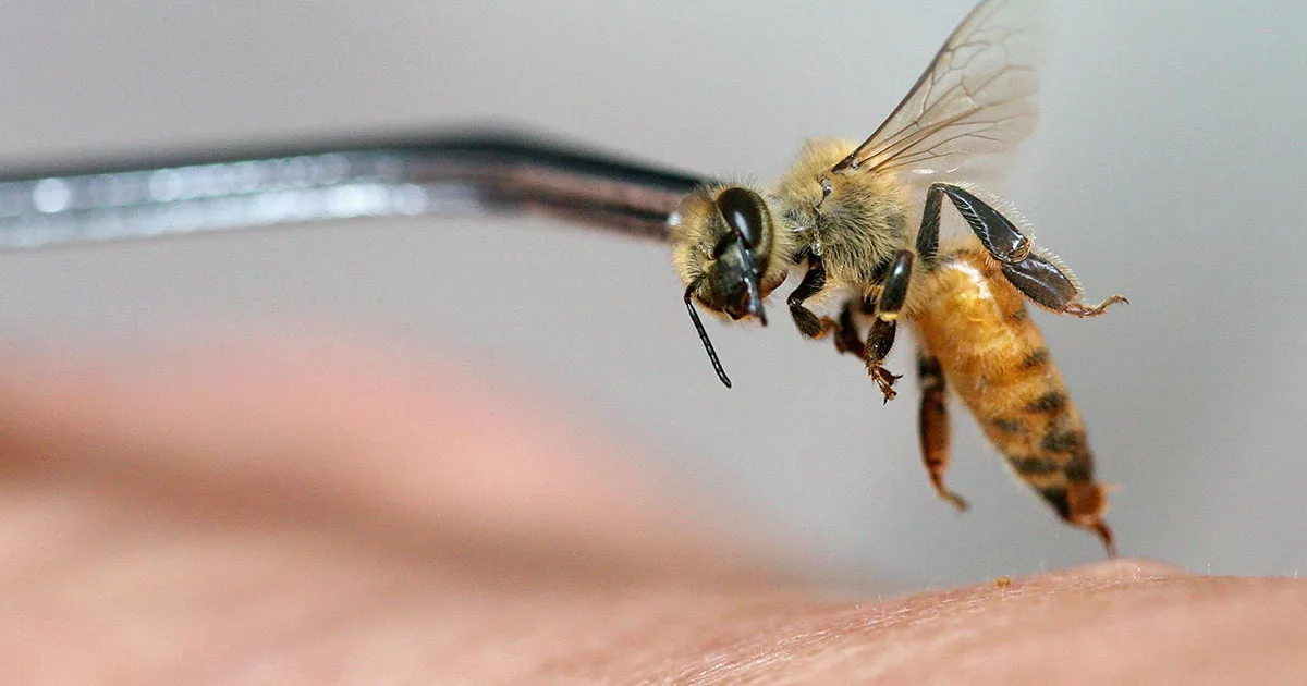 Close-up of a honeybee with syringe on human skin